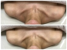 シェミー(CHEZ MEE)/即効性と持続力はデコルテから