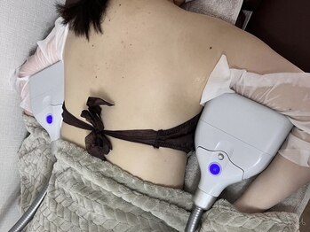 アモ(amo)の写真/二の腕のぷよぷよ肉をスッキリ解消◎気になる部位を集中ケアでスッキリ解消♪