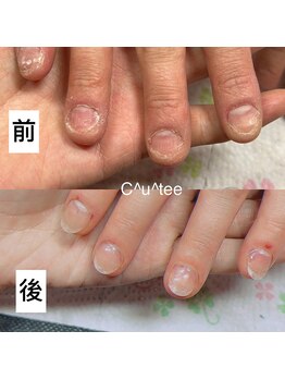 キューティー 錦糸町店(Cutee)/スカルプコース