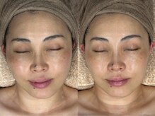 レボン(rebon)/【ボンバー】ビフォーアフター