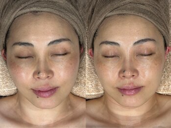 レボン(rebon)/【ボンバー】ビフォーアフター