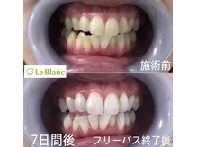 ルブラン 奈良店(Le Blanc)/7日間でここまでアップ！