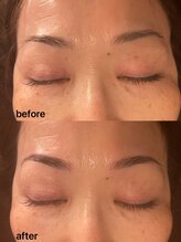 パピヨン(papillon)/ハリウッドブロウリフト【HBL】