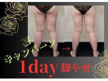 スマイルデイズ(Smiledays)