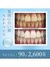 【あと9名限定】迷ってる今がチャンス！白さに驚くホワイトニング初回¥2,600