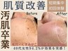 【平日限定】後悔しない肌に！シミ、シワ作らない！増やさない！初回体験