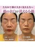  【写真映え】 歪み左右差を整え自信の持てる顔へ! バランス矯正×水光肌ケア