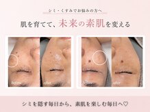 エン(en.)
