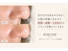 リルーエ(RIRUHE)の雰囲気（心地よく続けられるようなお手入れをご提案いたします）