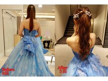 ルフレ(REFLET)/【事例16】Before/After痩身