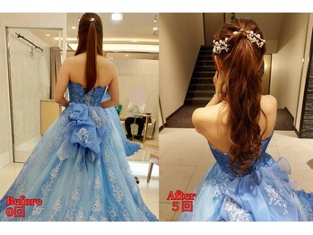 ルフレ(REFLET)/【事例16】Before/After痩身