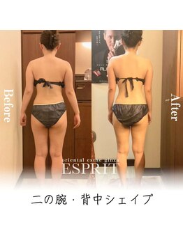 エスプリ 銀座店/銀座痩身・痩せる・ダイエット