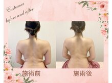 ピュアジューン 錦糸町(Pure June)の雰囲気(1回の施術でも効果を実感!日頃の疲れをかっさでデトックス!)