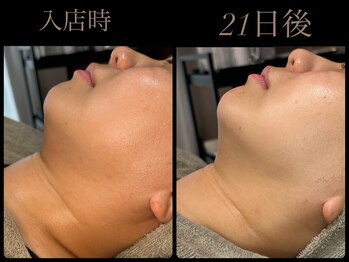 ビーエルティー(blt)/レモンボトル