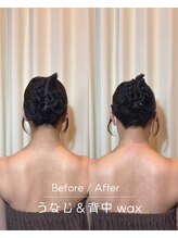 メローワックス 横浜店(MELLOW WAX)/【横浜駅/脱毛/ワックス/光】