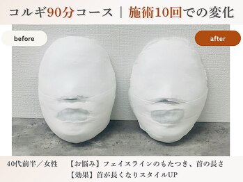 エルマ(elma)/コルギ90分before&after