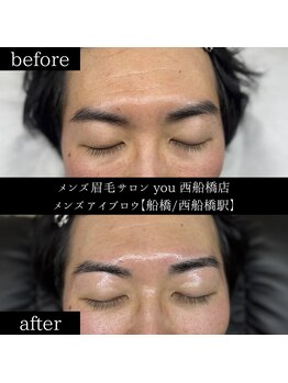 ユー 西船橋店(you)/ビフォーアフター写真