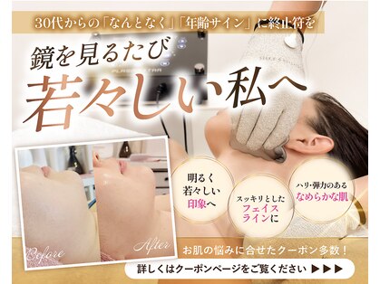 シュシュ(Chouchou)の写真
