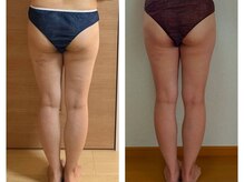 ヨサパーク セレナ(YOSA PARK)の雰囲気（溜まった老廃物も出していくので、肌質も変化します☆）