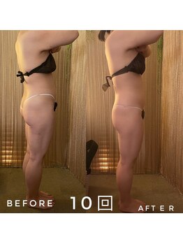 ミズキ(MIZUKI)/ハイパーナイフ8回効果