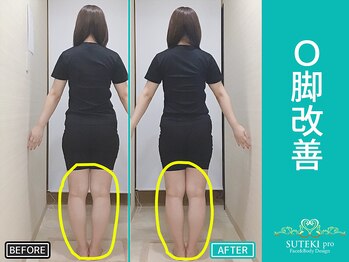 美骨矯正 ステキプロ(SUTEKI pro)/巻肩・骨盤矯正・ボディメイク