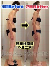 ルンソルテ(lunsoleto)/腰痛、猫背、しびれ、肩凝り