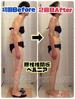 ルンソルテ(lunsoleto)/腰痛、猫背、しびれ、肩凝り