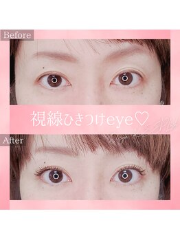 コトリ(kotori)/デザインキープラッシュ