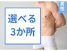 男性【選べる3か所】最新THR脱毛☆剛毛までしっかり脱毛！効果間違いなし！