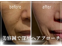 天神美容鍼99(KUKU)の雰囲気（諦めなければ、ここまで変わる♪）