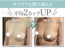美人バスト 千早店