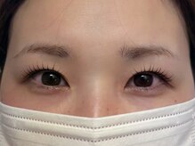 エイジレス(AGELESS)/ポイント→根元の被さりを避ける