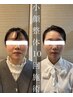 【エラ張り・食いしばり改善】小顔になりたい方の小顔整体¥11000→¥3980◎