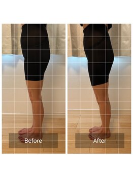 ラナン(Ranun)/きゅんきゅんヒップ