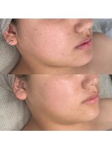 ラウレア(Laule'a)/【肌管理】大人水光肌 艶透明感