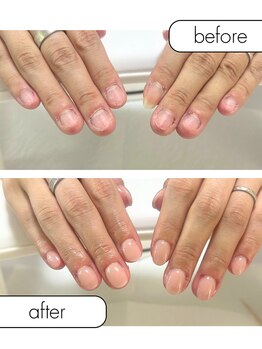 ピノ(pino)/◆深爪矯正＋自爪風仕上げ◆