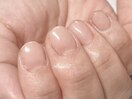 クリアネイル