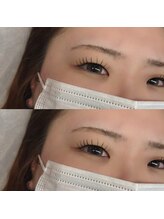 エニーアイラッシュ 高砂店(ANY Eyelash)/LED flatlash