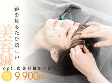 オプト(opt.)の雰囲気(【あきらめを自信に変える】 opt. 自慢の美容鍼+小顔矯正)