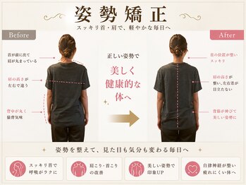 練馬アカデミア美容整体院/姿勢矯正 巻き肩 ブライダル整体