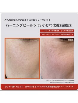 コルギサロン 伏見店(k_korugi.salon)の写真/【京都初上陸】次世代レチナルピーリングで内側から発光するような極上の水光肌へ！ニキビ・黒ずみ◎