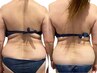 【気になる部位の脂肪分解】レモンボトル6~12cc|¥18500~