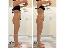 スキニー 六本木店(Skinnie)/32歳女性120分コース2回目