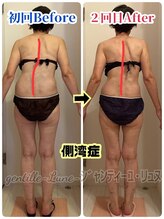ルンソルテ(lunsoleto)/猫背、巻肩、腕上がらない