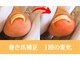 巻き爪専門ラボ 豊田店の写真