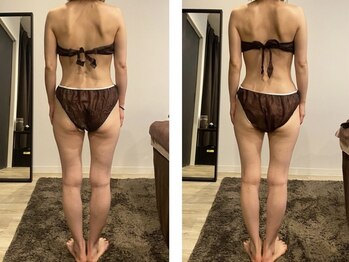 アールプラス(R+)/