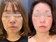 美々永 ビビッド(vivid)の雰囲気（まるで別人、信じられない…そんな方にこそぜひ体験してほしい）