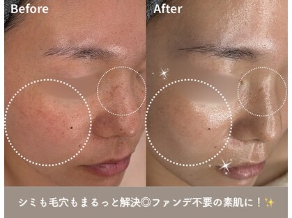 ビオエル(Bioell)の写真