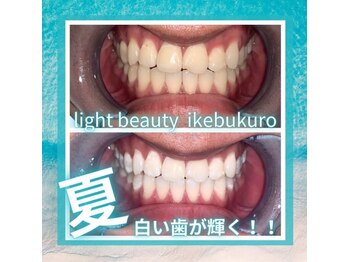 ライトビューティー 池袋店(LightBeauty)/症例写真