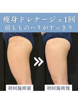 エミーニー(emiiny)/痩身ドレナージュ1回
